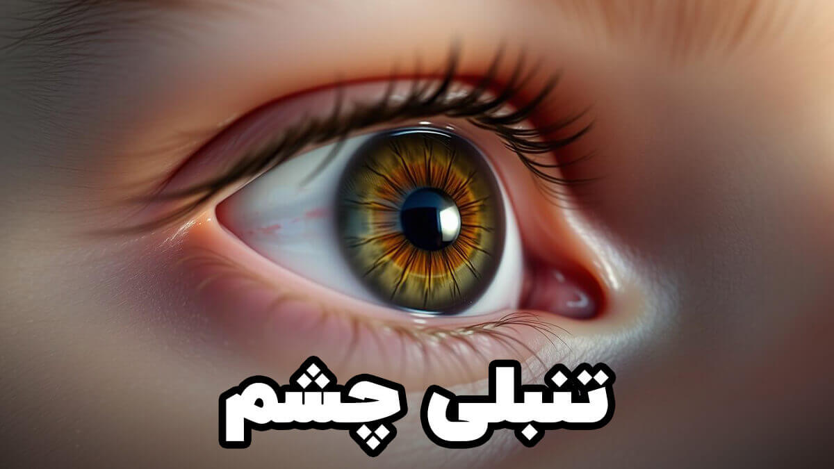 amblyopia symptoms diagnosis treatment 1